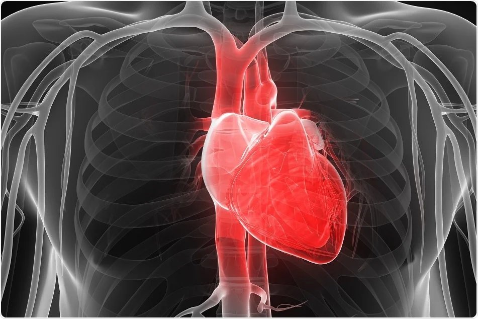 Stem Cell Treatment for Ischemic Cardiomyopathy