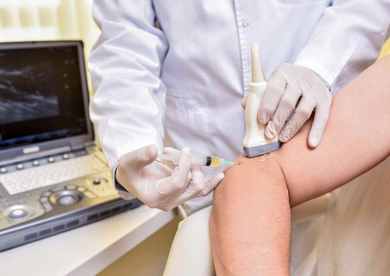 Stem Cell Treatment for Golfer's Elbow or Tennis Elbow