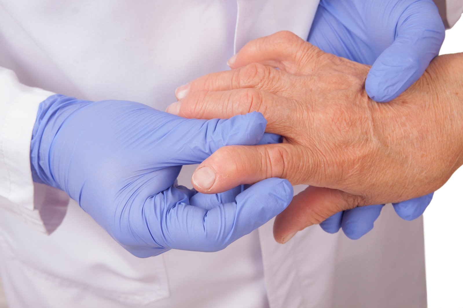 Stem Cell Therapy for Rheumatoid Arthritis & Osteoarthritis