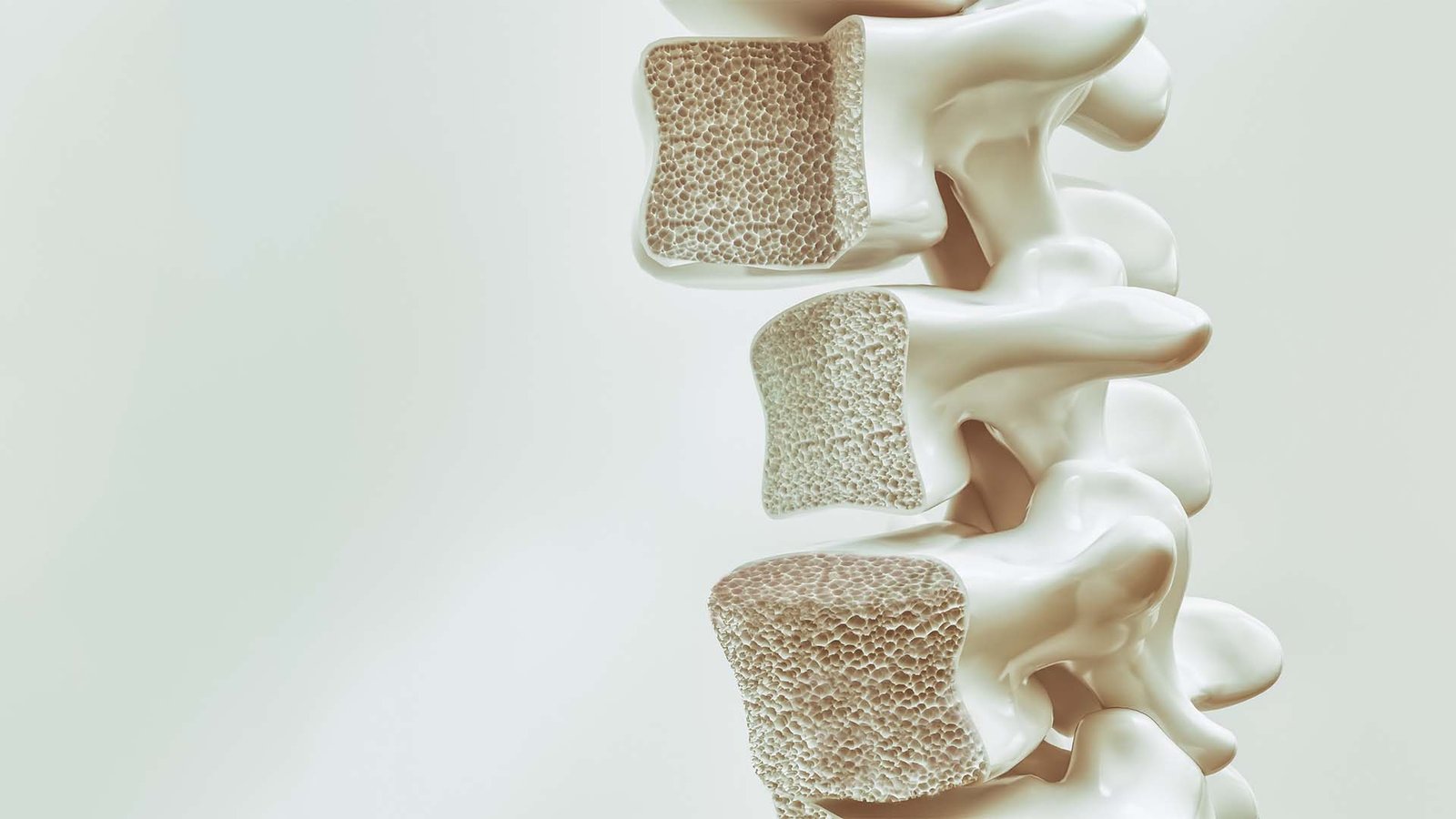 Stem Cell Therapy for Osteoporosis Treatment