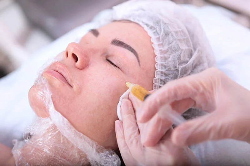 Stem Cell Treatment for Facelift